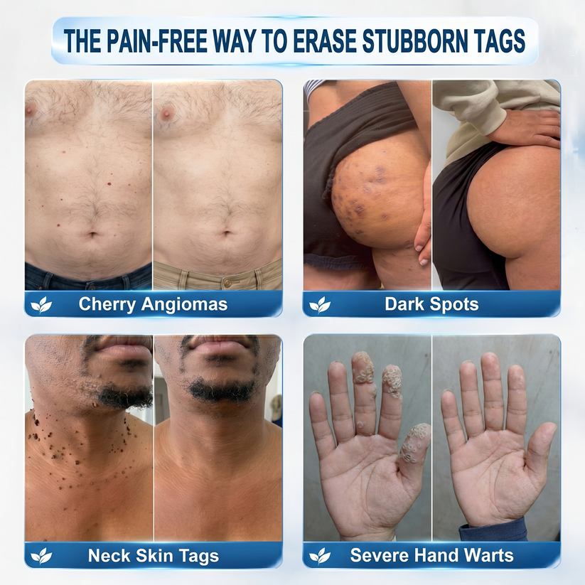 𝐎𝐟𝐟𝐢𝐜𝐢𝐚𝐥 𝐁𝐫𝐚𝐧𝐝 𝐒𝐭𝐨𝐫𝐞 |✅🛡️7-𝐷𝑎𝑦 𝗧𝐚𝐠 & 𝗦𝗽𝐨𝐭 𝐄𝐫𝒂𝒔𝒆𝒓(Zero Pain, Zero 𝐒𝐜𝐚𝒓𝒔 Rollerball)