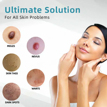 ✨VelvetSkin+™ All-in-One CO₂ Laser Eraser Pen | Removes Moles, Warts, Skin Flaws & Pigmentation Big Sale