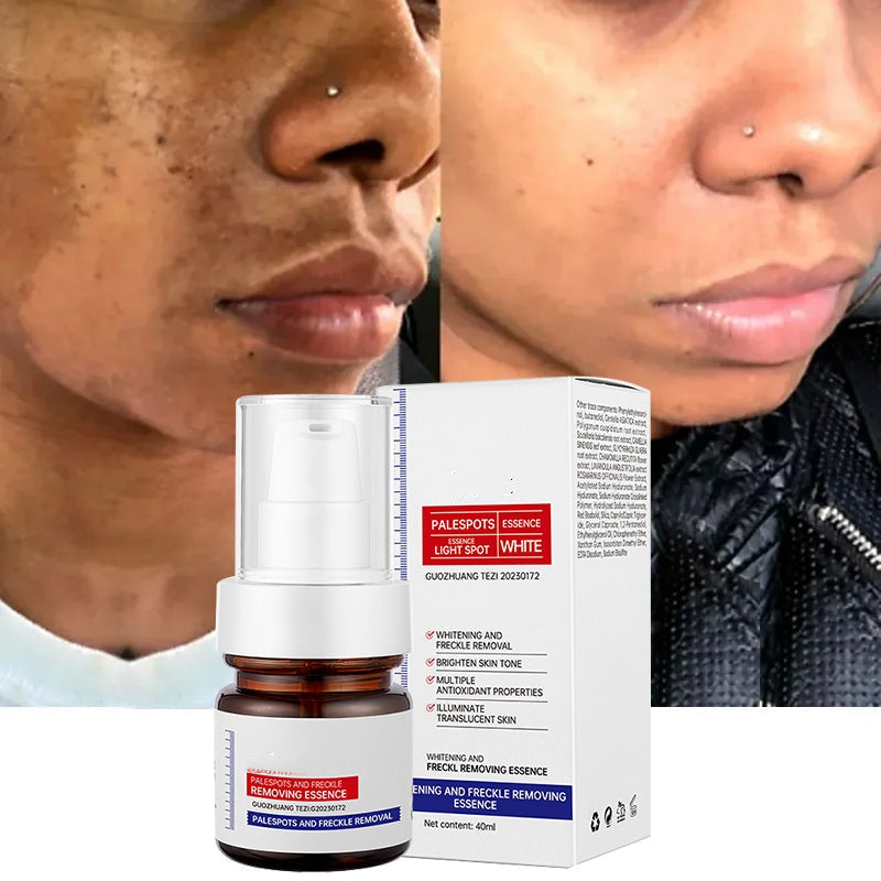 Dark Spot Remover for Face & Body | Advanced Corrector Serum for Age, Melasma, Sun, Acne, Black Spots | Tranexamic Acid, Niacinamide Formula for Women & Men Big Sale