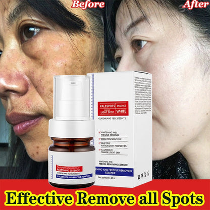 Dark Spot Remover for Face & Body | Advanced Corrector Serum for Age, Melasma, Sun, Acne, Black Spots | Tranexamic Acid, Niacinamide Formula for Women & Men Big Sale