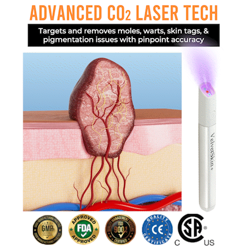✨VelvetSkin+™ All-in-One CO₂ Laser Eraser Pen | Removes Moles, Warts, Skin Flaws & Pigmentation Big Sale