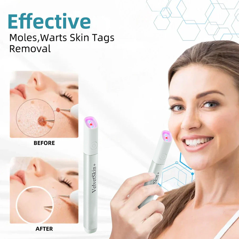 ✨VelvetSkin+™ All-in-One CO₂ Laser Eraser Pen | Removes Moles, Warts, Skin Flaws & Pigmentation Big Sale