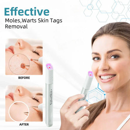 ✨VelvetSkin+™ All-in-One CO₂ Laser Eraser Pen | Removes Moles, Warts, Skin Flaws & Pigmentation Big Sale