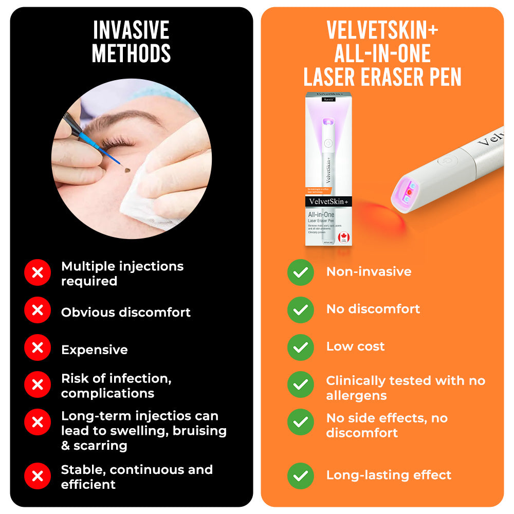 ✨VelvetSkin+™ All-in-One CO₂ Laser Eraser Pen | Removes Moles, Warts, Skin Flaws & Pigmentation Big Sale