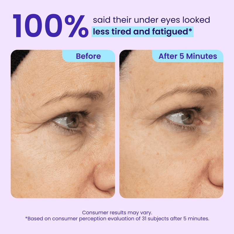 Final 3 Hours: 60%OFF🔥 Instant Lift Eye Gel for Puffiness, Bags & Dark Circles