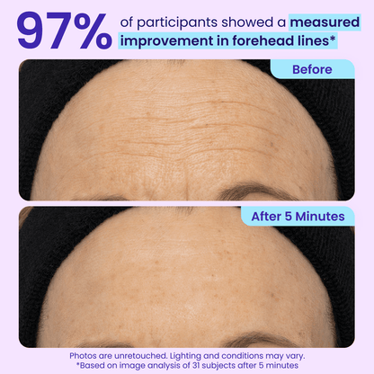 Final 3 Hours: 60%OFF🔥 Instant Lift Eye Gel for Puffiness, Bags & Dark Circles